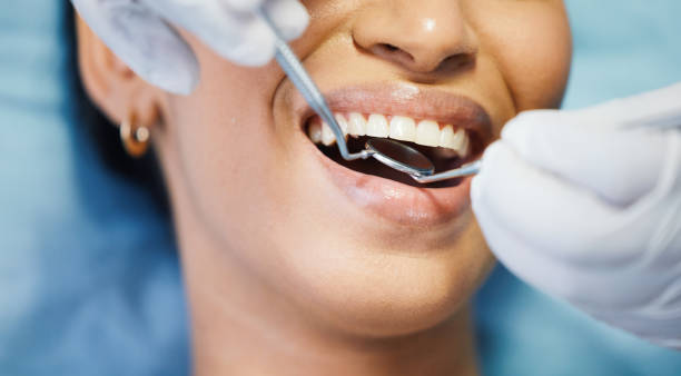 Best Emergency Dental Care for Broken or Chipped Teeth in Spring Creek, NV