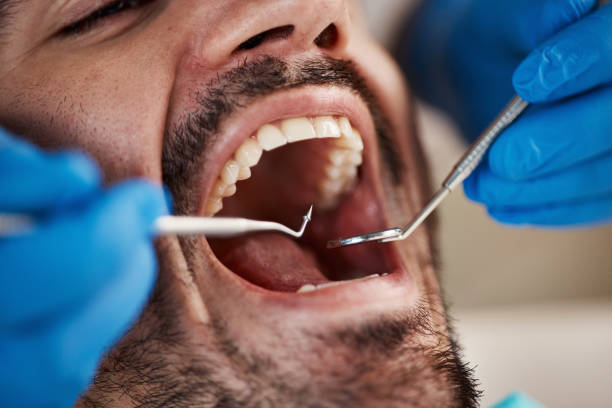 Best Emergency Dental Care for Broken or Chipped Teeth in Spring Creek, NV